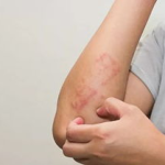 私密痒肿胀疼要怎么处理呢,应对策略与护理指南